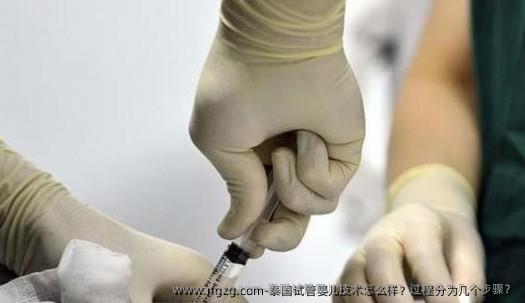 泰国代孕技术怎么样？过程分为几个步骤？