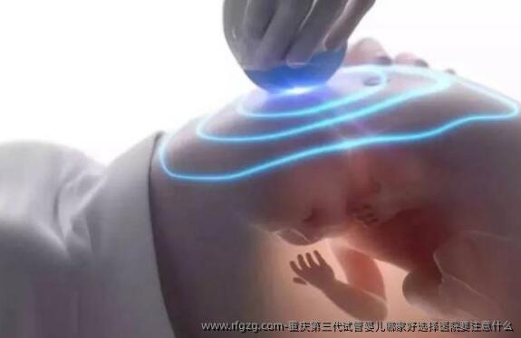 重庆第三代代孕哪家好选择医院要注意什么