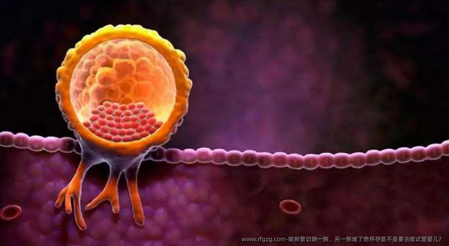 输卵管切除一侧，另一侧堵了想怀孕是不是要去做代孕？