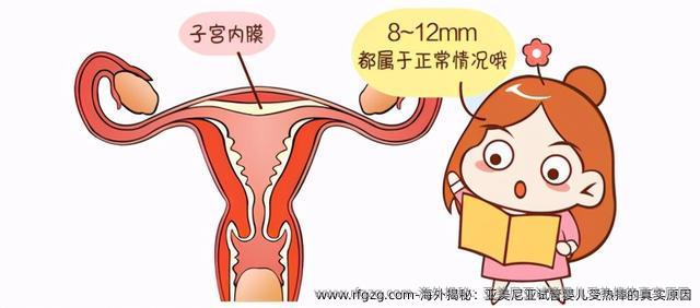 海外揭秘：亚美尼亚代孕受热捧的真实原因