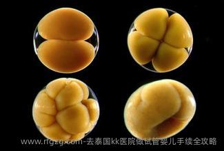 去泰国kk医院做代孕手续全攻略