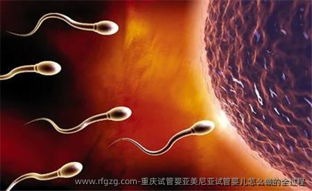 重庆试管婴亚美尼亚代孕怎么做的全过程