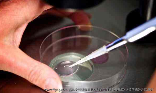 高龄女性代孕移植子宫内膜多厚较好-移植内膜多少度较好
