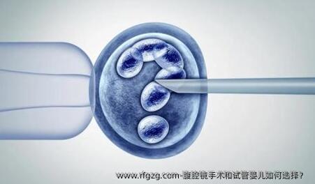 腹腔镜手术和代孕如何选择？ 